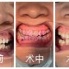 我院口腔科开展PMTC清洁术，为您的口腔健康保驾护航