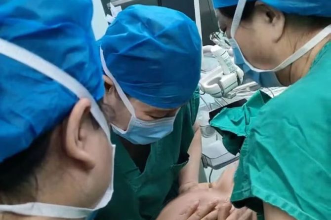 生命旋转之舞——王府医院产科团队为孕39周准妈妈行臀位外倒转术